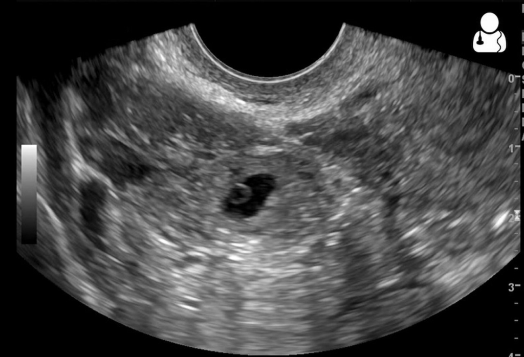 1280px UOTW 61 Ultrasound of the Week 1